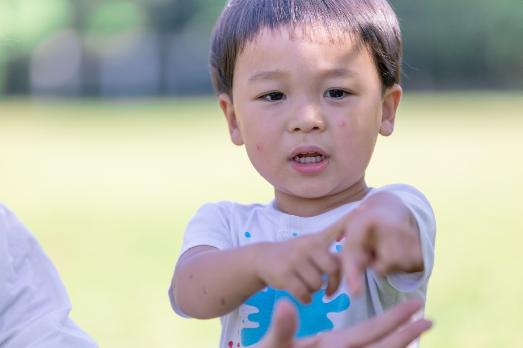 とびひ 保育園 幼稚園はいつから登園ok プールは うつさないために気をつけること Kosodate Life 子育てライフ