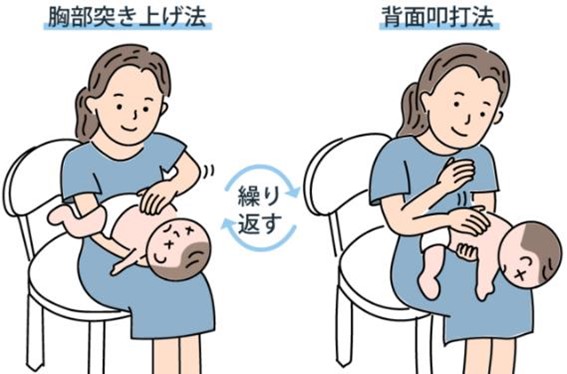 赤ちゃんが嘔吐の対処 黄色 緑の嘔吐は注意 元気そうなときは 医師監修 Kosodate Life 子育てライフ