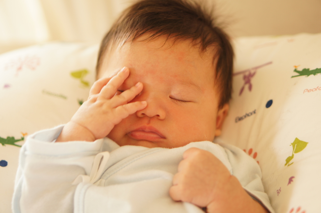 赤ちゃんの目の周りが赤い 治し方は 病院は何科 こする すぐ消えるときは 医師監修 Kosodate Life 子育てライフ
