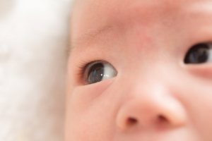 赤ちゃんの目が充血！結膜炎やアレルギーかも。病院は眼科？小児科？