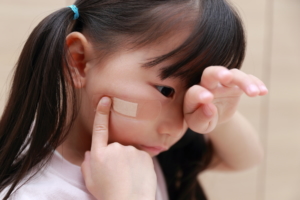 医師が教える【顔の傷を早く治す方法】子どものひっかき傷・擦り傷・切り傷