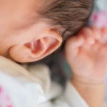乳児湿疹　耳