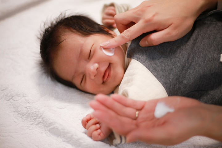 乳児湿疹が 顔だけ ひどい原因 顔の洗い方 保湿方法 受診目安も Kosodate Life 子育てライフ