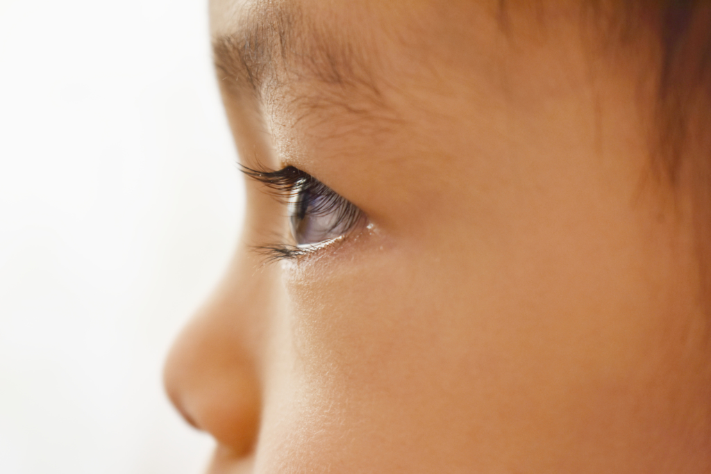 子どもの目の周りの湿疹 赤いぶつぶつの原因 病院は何科 Kosodate Life 子育てライフ