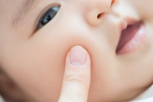 赤ちゃんの顔・腹の肌がザラザラ…もしやアトピー？何科にいけばいい？