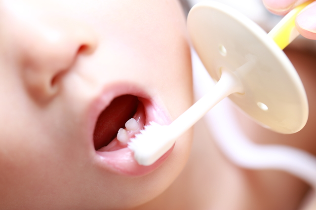 茶色い乳歯は 虫歯 それとも着色汚れ 放置するのは 歯科医監修 Kosodate Life 子育てライフ
