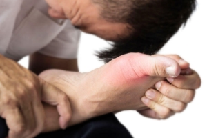 痛風？「足の親指の付け根が痛い」今できる対処法。病院は何科？