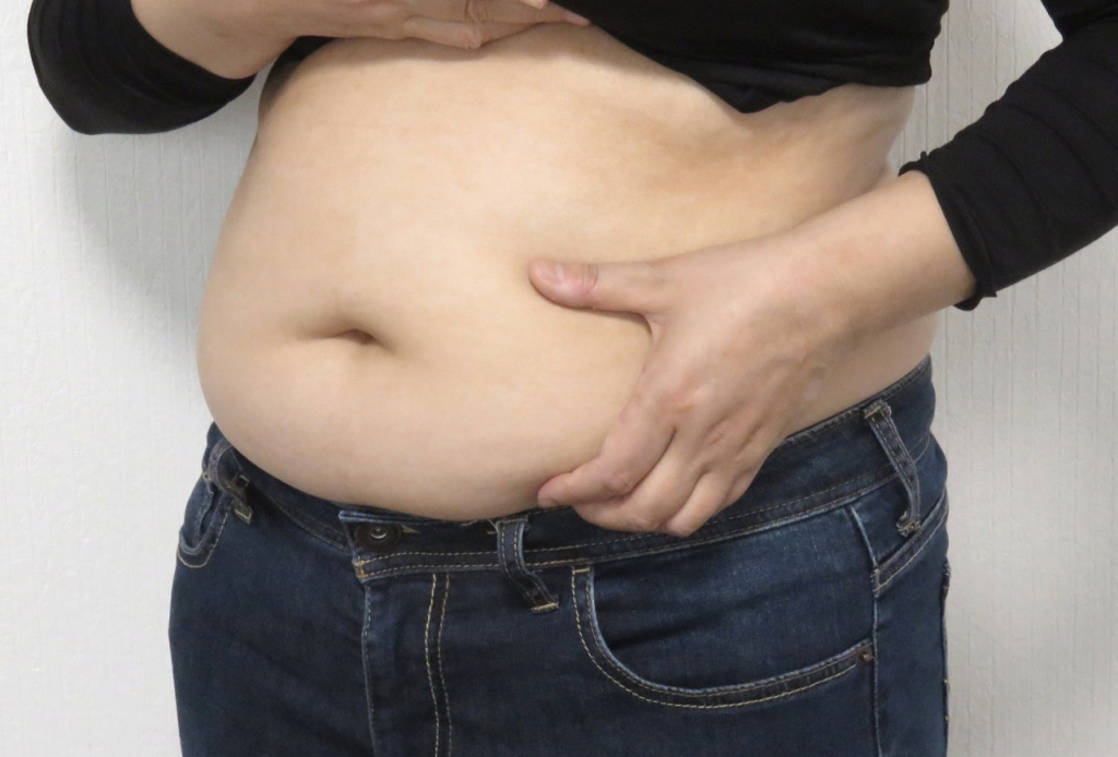 「太り過ぎ」が原因になる3つの病気。肥満が体調不良につながる仕組み