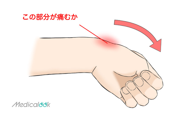 親指側の手首が痛い ドケルバン病は病院に行くべき テーピングの仕方も Medicalook メディカルック