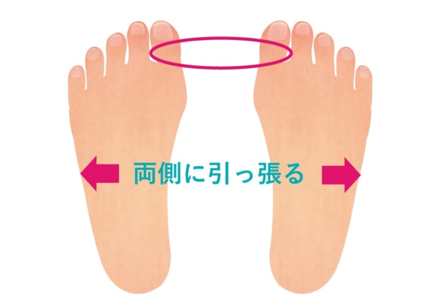 足の親指の付け根が痛い…女性に多い｢外反母趾｣の対処法。病院は何科？ Medicalook(メディカルック)