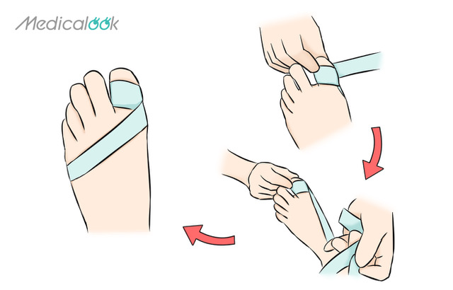 裏 の 痛い 足 親指 の 足の裏が痛い原因に注意。足裏のツボが大事です。