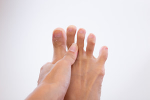 足指の骨折の見分け方｜腫れが引かない時は要注意！放置するとどうなる？