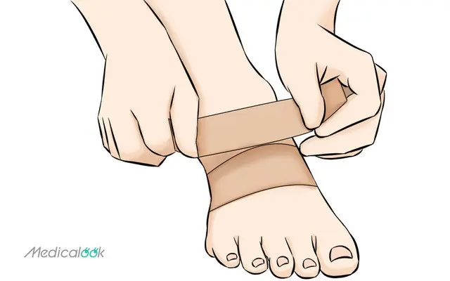 足の甲　腱鞘炎