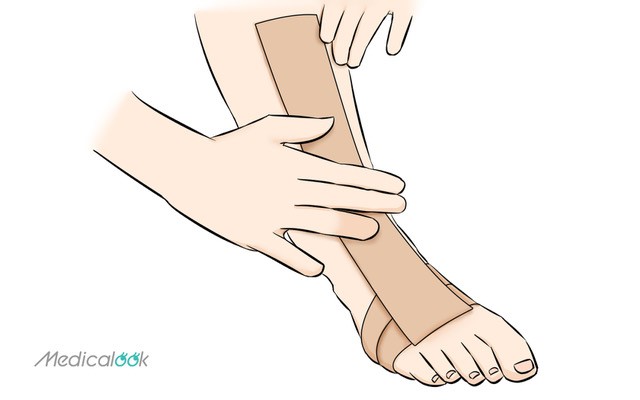 足の甲が痛いのは腱鞘炎が原因かも ギシギシしたら要注意 湿布やテーピングも Medicalook メディカルック