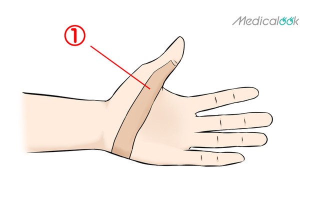 親指を曲げると痛い 関節や付け根の痛み 腫れ テーピングの巻き方は 病院は何科 Medicalook メディカルック