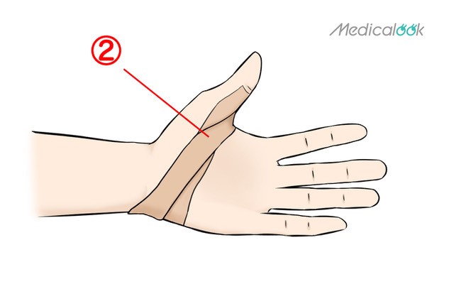 親指を曲げると痛い 付け根の痛み 突き指のテーピングの巻き方 ばね指 の原因と対処も Medicalook メディカルック