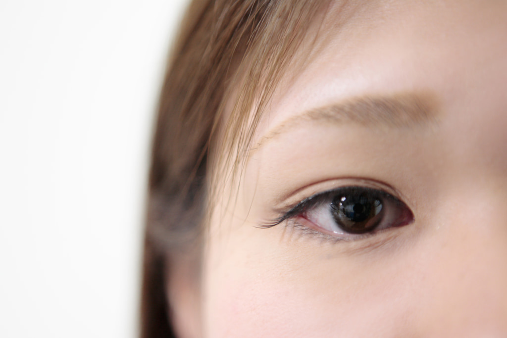 目の周りの白いプツプツ の原因 自分で取れる 老化のせい 皮膚科の取り方も Medicalook メディカルック