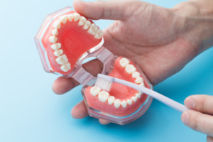 大人の歯「下の歯が内側に倒れる」6つの原因。放置すると？矯正できる？
