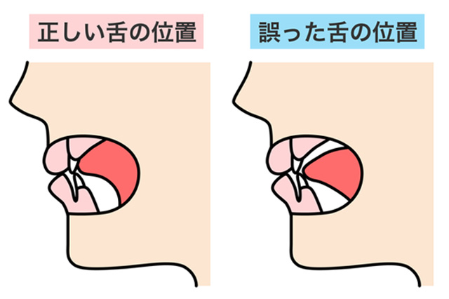 舌の位置